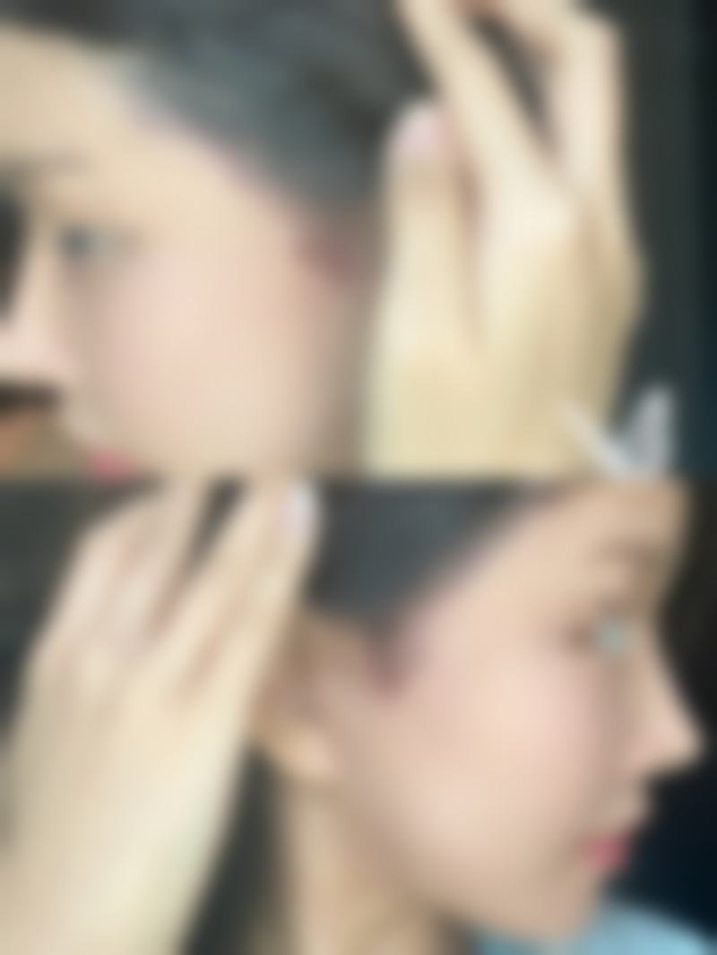 十、相关科普内容推荐——黄褐斑诊疗