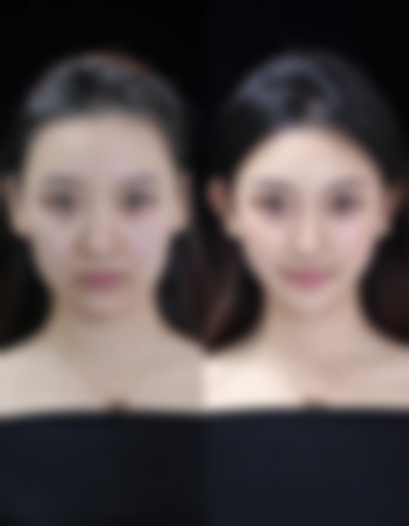 1、主要做的三大诊疗项目