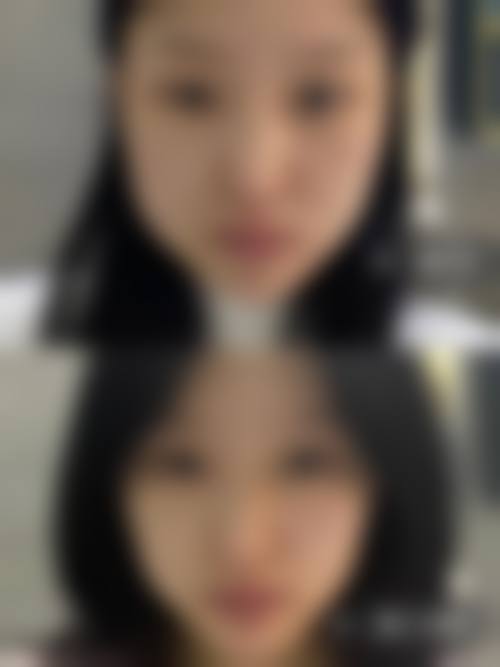 七、薛开兴医生2026年收费标准一览