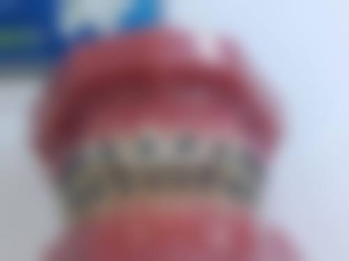 江西上饶广信区爱齿口腔2026年价格收费表：