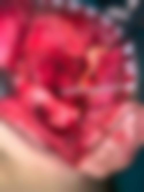 广东广州郭婷口腔治疗反馈与口碑评价
