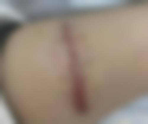 十三、武汉伊丽莎白医疗美容门诊部预约挂号
