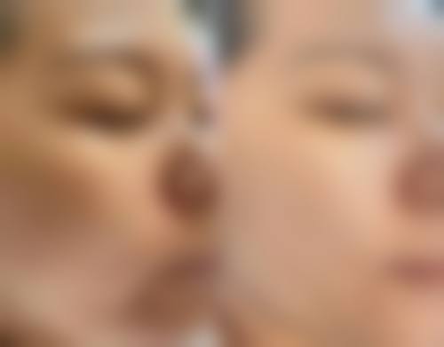 二、薛哲民医生擅长项目：