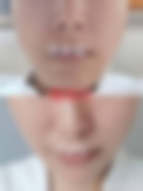 二、缪勇医生擅长项目介绍