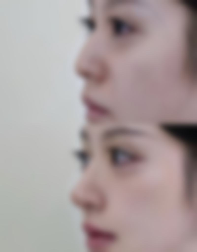 六、薛开兴医生口碑怎么样？