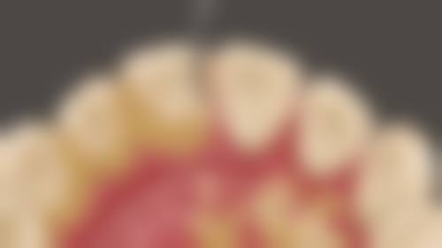 长沙优植口腔医院的项目价格