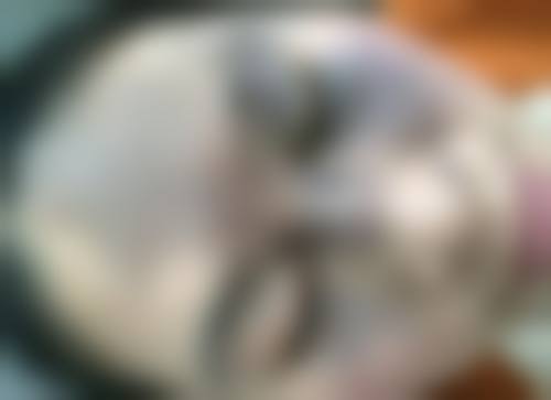 七、中山艺美铜程医疗美容诊所特色项目技术怎么样