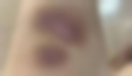 2、深圳爱氏医疗美容门诊部是正规医院吗？正规资质查阅：
