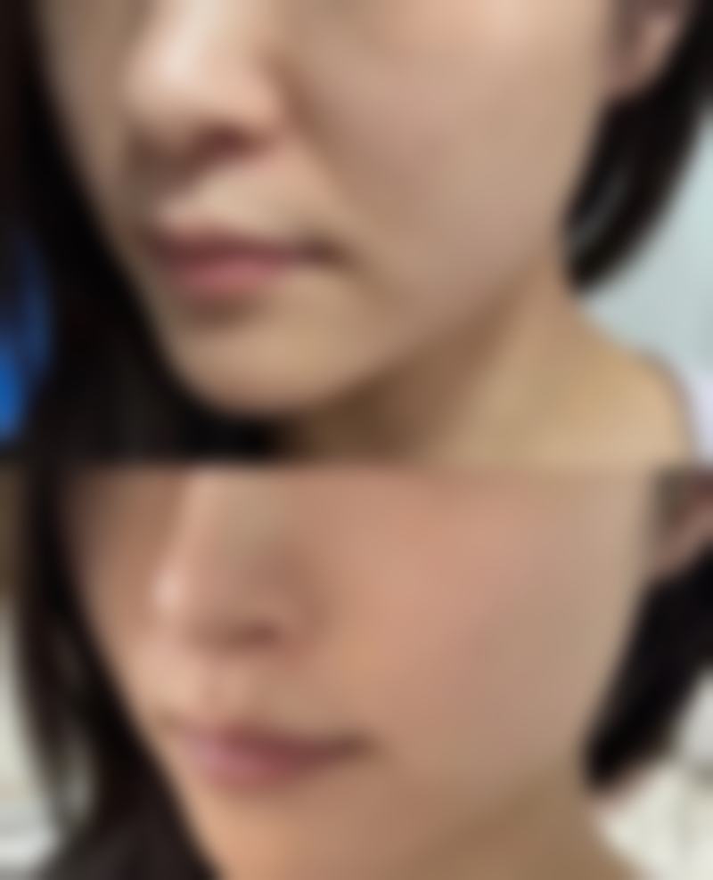 韓國愛她ATOP預約掛號2026全新3招！BeautsGO呢招更快更慳錢