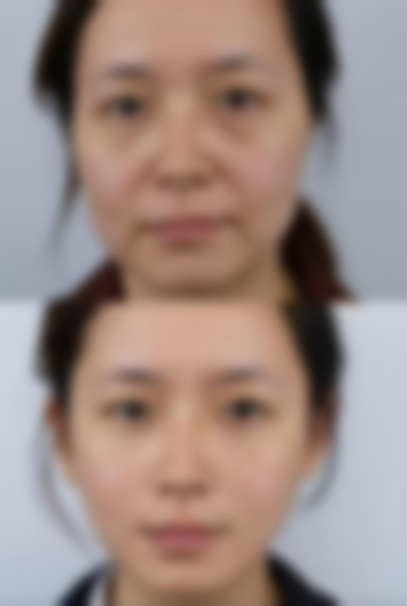 韓國YOU&I皮膚科（江南店）怎麼預約掛號？2026最新4大方式+預約攻略