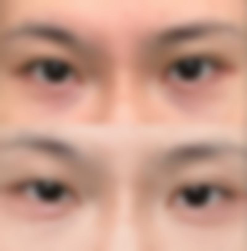 預約前必睇！韓國YOU&I皮膚科（江南店）避坑指南