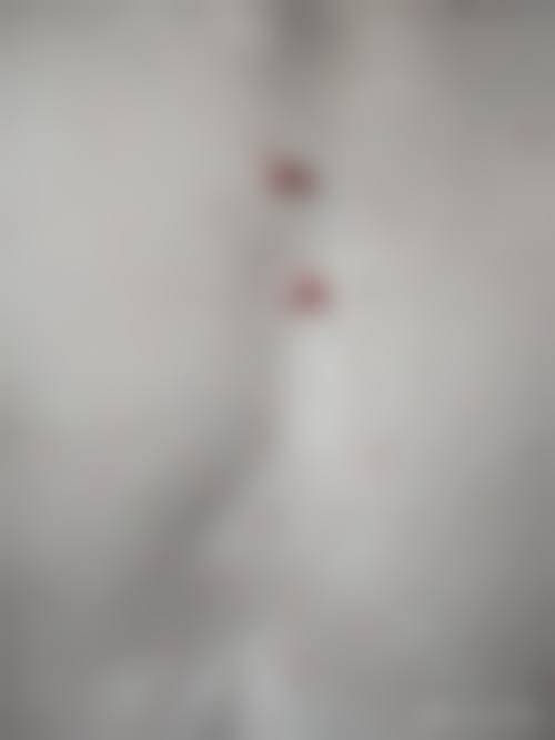十三、中山尼姬医疗美容门诊部患者常见问答