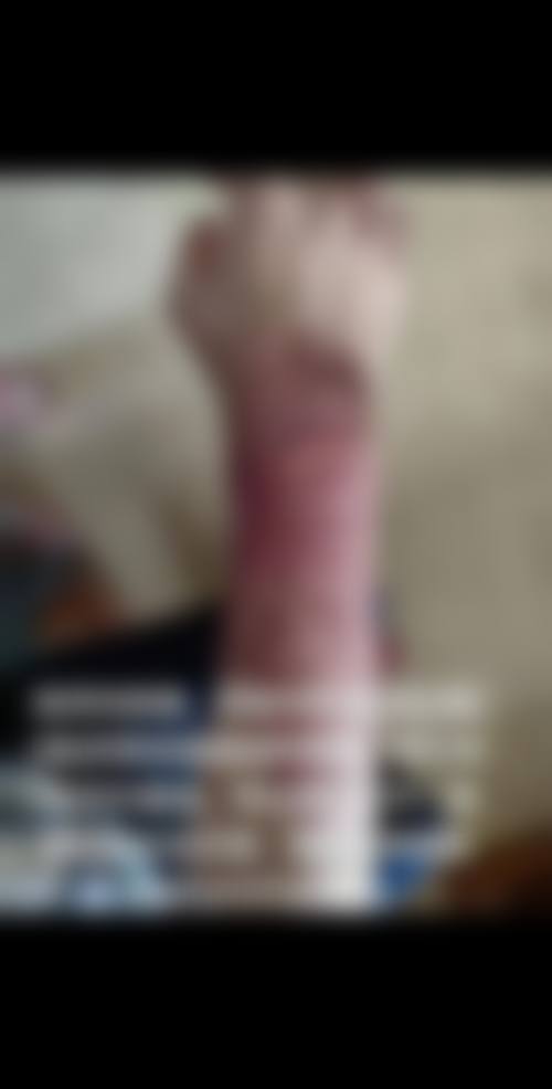 广州俏韵整形医院口碑如何
