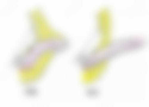 拓展延伸:韓國開眼頭常見疑問+避坑指南