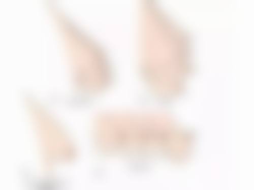 韓國開眼頭會不會特别假 價錢範圍:香港、澳門、深圳/珠海邊度更抵?