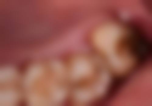 珠海承隆口腔醫生團隊評價:年輕但夠細心?