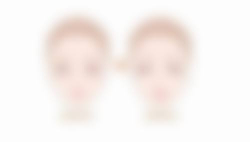 韓國開眼頭會不會特别假 真實实例:香港澳門姊妹做完點樣?