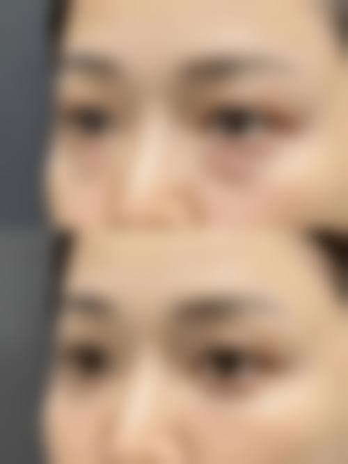 七、就诊流程与注意事项(术前术后)