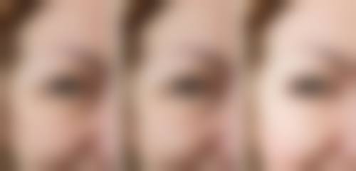 三、王义斌医生擅长项目介绍