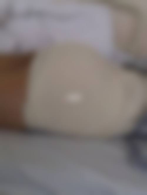 八、患者真实就诊体验 / 口碑实例反馈一例