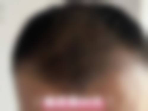 三、黄朝帅医生擅长项目与适合人群