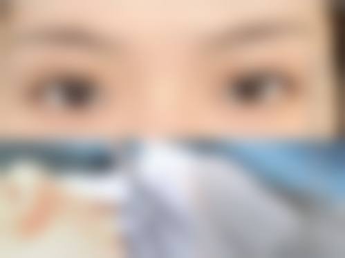 韓國必妩雙眼皮自然嗎 诊所拣选要点(香港/澳门)