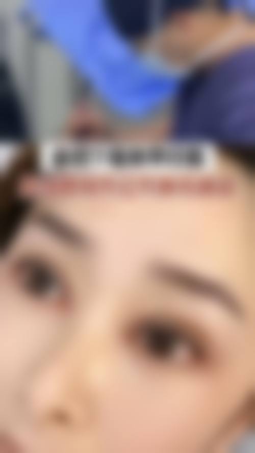 韓國必妩雙眼皮自然嗎 适合边类人群?