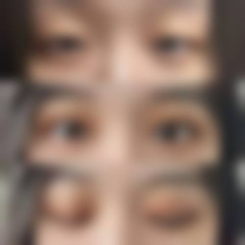 韓國必妩雙眼皮自然嗎 技术特色解析