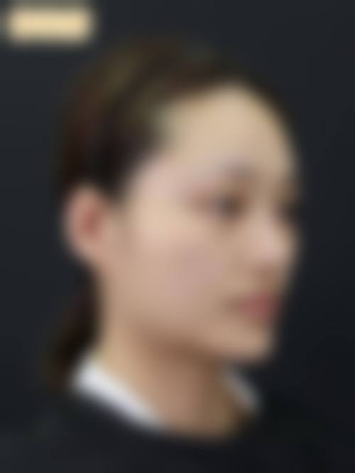 金男昊医生手术成效