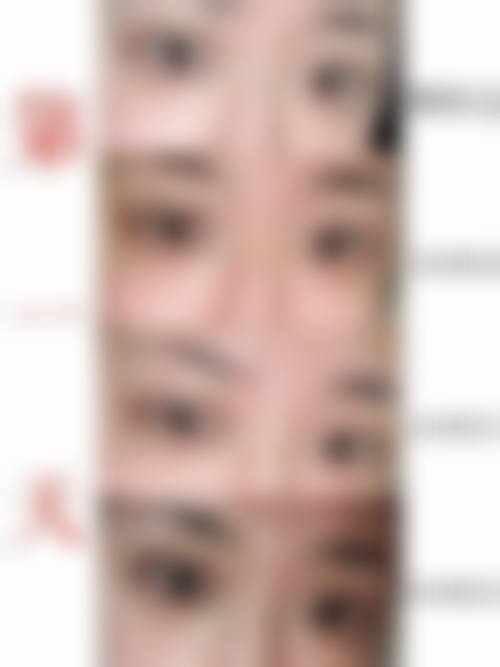 2026真人实例:香港vs澳門姊妹术后反馈