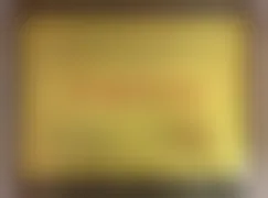 哈尔滨普瑞干眼理疗项目技术优势及服务优势