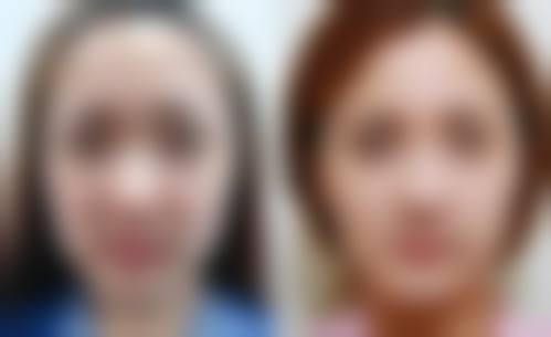 资阳维多利亚医疗美容医院擅长项目。