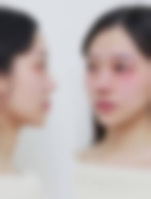 江苏苏州园区美莱医疗整形美容擅长项目。