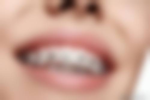 优惠活动详情与预约方式
