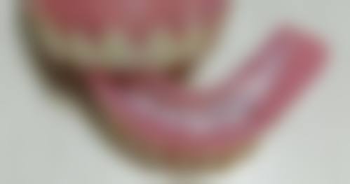 临床实例分享