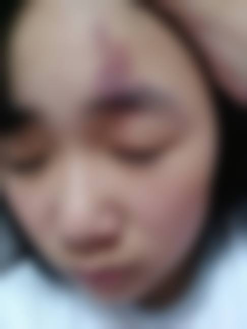 十一、患者常见问题解答(精选)