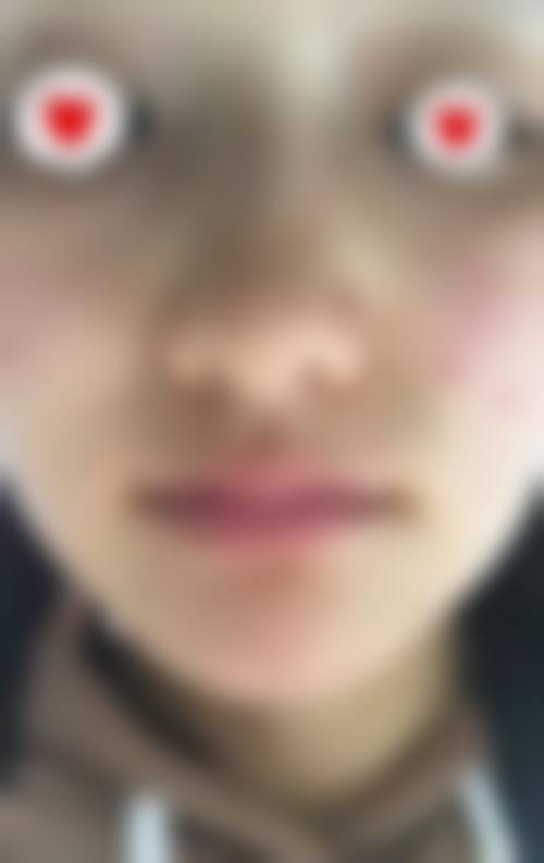 海南海口壹加壹医疗美容门诊部治疗反馈与口碑评价。