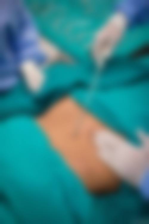 江苏苏州园区美莱医疗整形美容预约挂号方式。