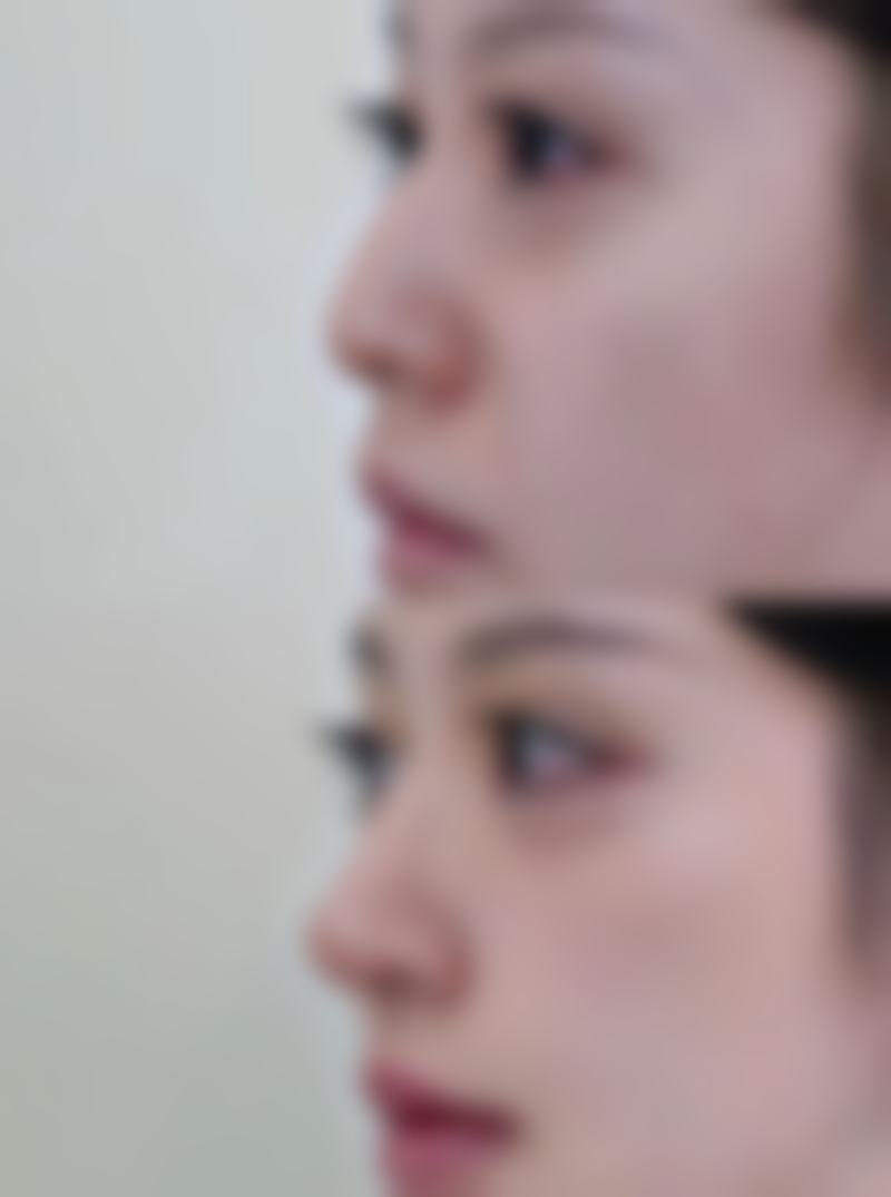 韓國男生下顎線打造推薦:明星V臉標準參考