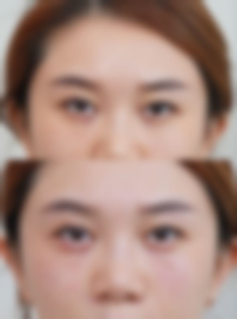 1. 術前準備：香港返工族vs澳門媽咪各有妙招
