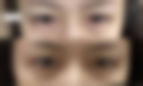 2. 高漢雄院長(首爾Faceplus整形外科):「男生眼型定制大師」