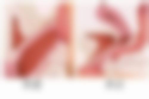 韓國植髮 vs 內地(深圳/珠海)邊個好?港澳姊妹實測對比