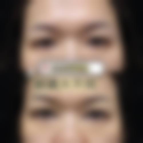 伊宁禾颜懿美整形医院治疗反馈与口碑评价。