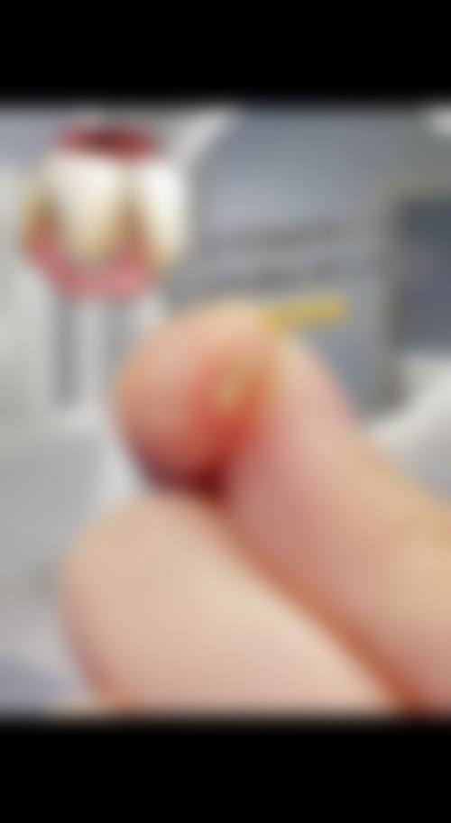 陕西西安张振华口腔诊所擅长项目。