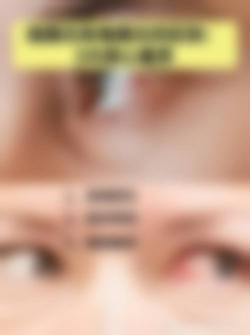 阜南县人民医院眼科设备精良。
