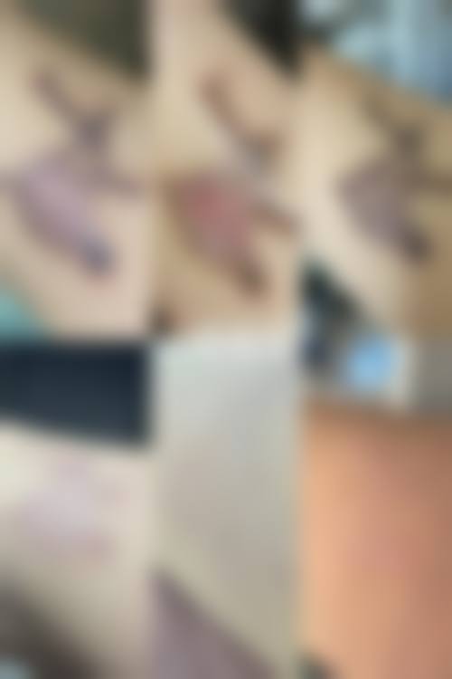 五、驻马店美林苑整形医院真实实例参考