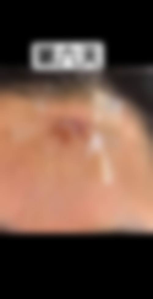 七、驻马店美林苑整形医院常见问题解答