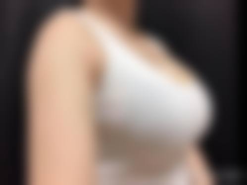 西安颐丰颜星医疗美容诊所擅长项目。