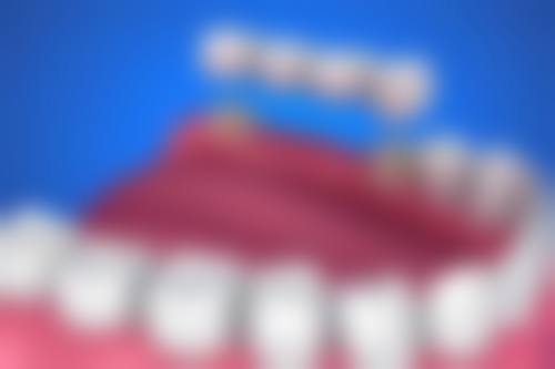陕西西安张振华口腔诊所治疗反馈与口碑评价。