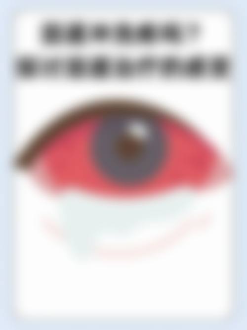 泸州爱瑞眼科医院医生团队经验稳定。